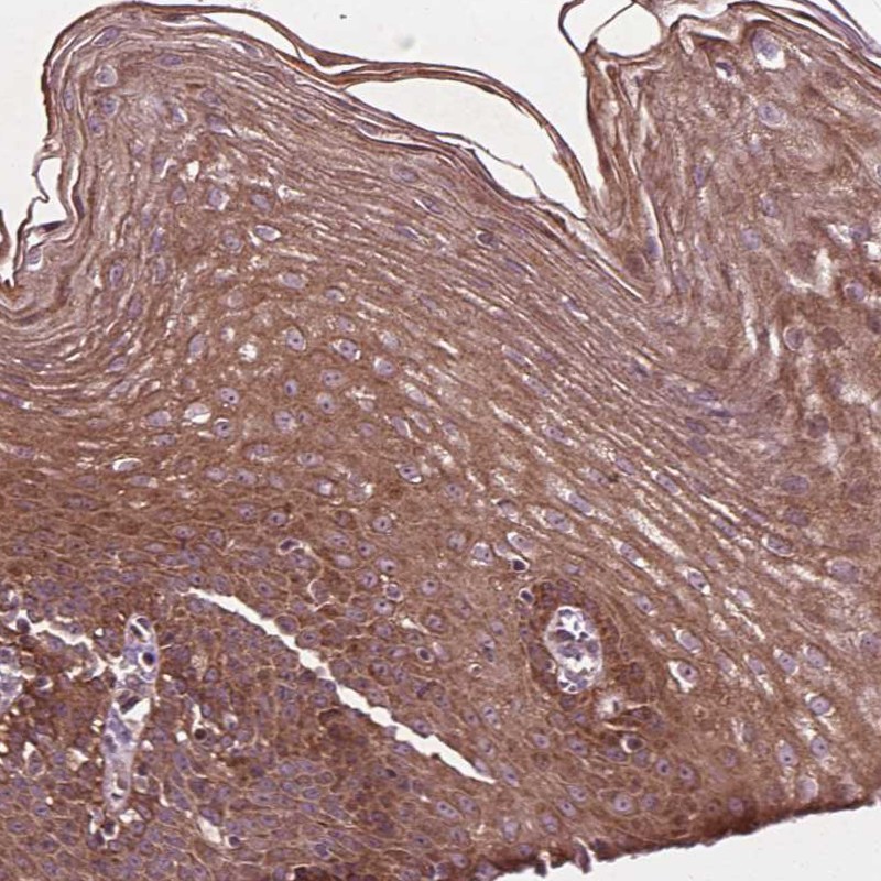 Anti-B3GALNT2 Antibody
