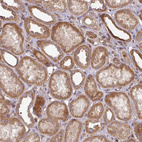 Immunohistochemical staining of human kidney shows moderate nuclear and cytoplasmic positivity in cells in tubules.