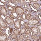 Immunohistochemical staining of human kidney shows moderate nuclear and cytoplasmic positivity in cells in tubules.
