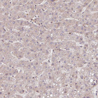 Immunohistochemical staining of human liver shows very weak cytoplasmic positivity in hepatocytes.