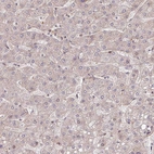 Immunohistochemical staining of human liver shows very weak cytoplasmic positivity in hepatocytes.