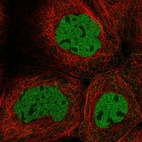 Anti-CASP2 Antibody