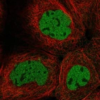 Immunofluorescent staining of human cell line A-431 shows localization to nucleoplasm.