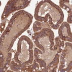 Immunohistochemical staining of human Duodenum shows moderate membranous and cytoplasmic positivity in glandular cells.