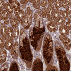 Immunohistochemical staining of human Stomach shows strong membranous and cytoplasmic positivity in glandular cells.