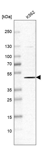 Anti-SLC35F2 Antibody