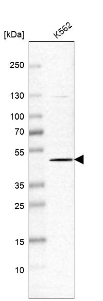 Anti-SLC35F2 Antibody