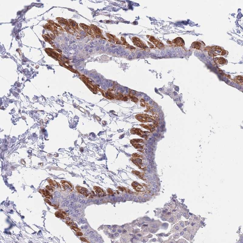 Anti-SLC7A6 Antibody
