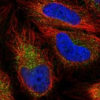 Immunofluorescent staining of human cell line HeLa shows localization to vesicles.