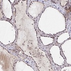 Anti-HIRA Antibody