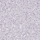 Immunohistochemical staining of human liver shows low expression as expected.