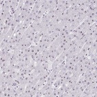 Anti-HIRA Antibody