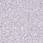 Immunohistochemical staining of human liver shows low expression as expected.