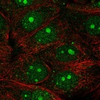 Immunofluorescent staining of human cell line MCF7 shows localization to nucleus & nucleoli.