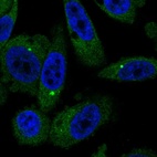 Anti-BMT2 Antibody