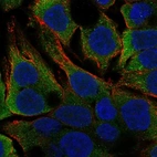 Immunofluorescent staining of human cell line OE19 shows localization to cytosol.