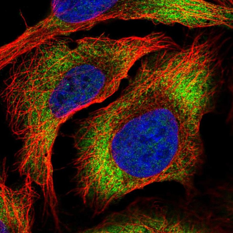 Anti-ZC3HAV1L Antibody