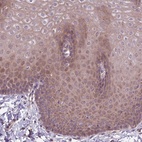 Anti-ITPKC Antibody