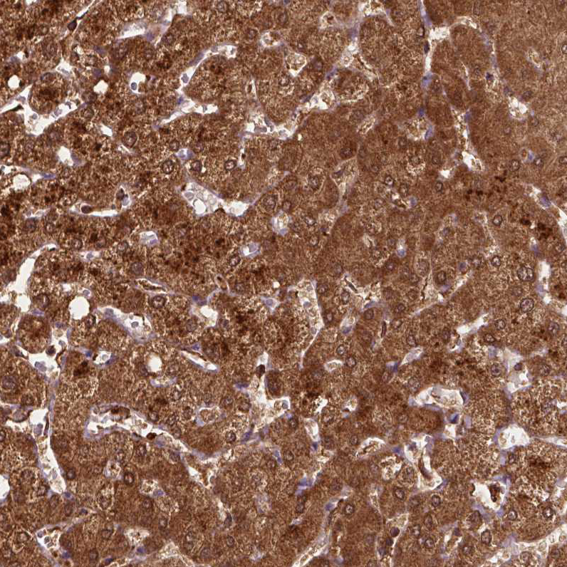 Anti-ZMYND19 Antibody