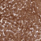 Anti-ZMYND19 Antibody
