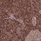 Immunohistochemical staining of human pancreas shows strong granular cytoplasmic positivity in exocrine glandular cells.