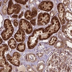 Immunohistochemical staining of human kidney shows strong cytoplasmic positivity in cells in tubules.