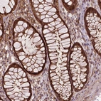 Immunohistochemical staining of human gastrointestinal shows strong cytoplasmic positivity in glandular cells.