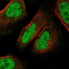 Immunofluorescent staining of human cell line U-2 OS shows localization to nucleus.