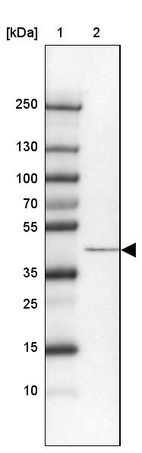 Lane 1: Marker [kDa] 250, 130, 100, 70, 55, 35, 25, 15, 10_br/_Lane 2: Human cell line RT-4