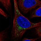 Immunofluorescent staining of human cell line U-2 OS shows localization to vesicles.