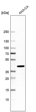 Western blot analysis in human cell line AN3-CA.