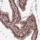 Immunohistochemical staining of human fallopian tube shows strong nuclear positivity in glandular cells.