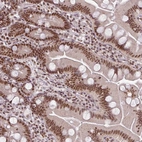 Immunohistochemical staining of human small intestine shows strong nuclear positivity in glandular cells.