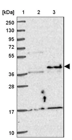 Lane 1: Marker [kDa] 250, 130, 95, 72, 55, 36, 28, 17, 10_br/_Lane 2: Human cell line RT-4_br/_Lane 3: Human cell line U-251MG sp