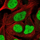 Immunofluorescent staining of human cell line U-2 OS shows localization to nucleoplasm.