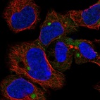 Anti-CHCHD7 Antibody