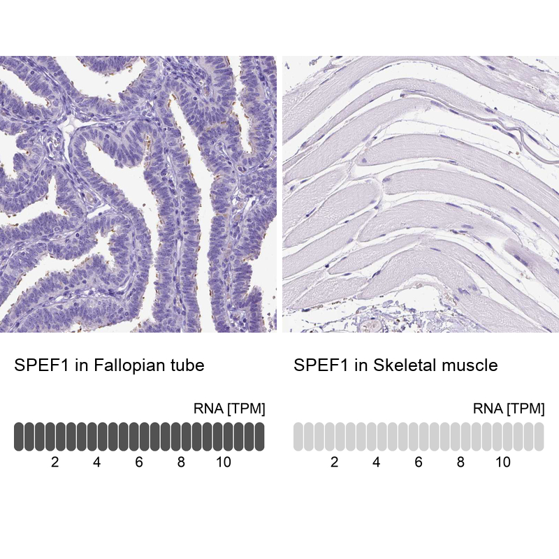 Anti-SPEF1 Antibody