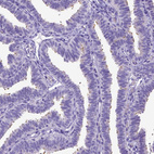 Immunohistochemical staining of human fallopian tube shows strong positivity in cilia in glandular cells.