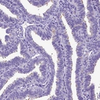 Immunohistochemical staining of human fallopian tube shows strong positivity in cilia in glandular cells.