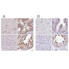 Immunohistochemical staining of human cerebral cortex, gallbladder, liver and testis using Anti-DR1 antibody HPA050785 (A) shows similar protein distribution across tissues to independent antibody HPA055308 (B).