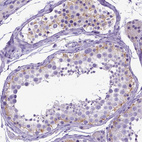 Immunohistochemical staining of human testis shows moderate cytoplasmic positivity in Sertoli cells.