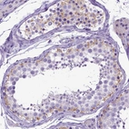 Immunohistochemical staining of human testis shows moderate cytoplasmic positivity in Sertoli cells.