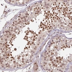 Immunohistochemical staining of human testis shows high expression.