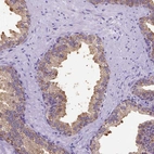 Immunohistochemical staining of human prostate shows moderate cytoplasmic positivity in glandular cells.