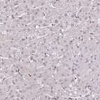 Immunohistochemical staining of human liver shows low expression as expected.