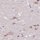 Immunohistochemical staining of human cerebral cortex using Anti-DR1 antibody HPA050785.
