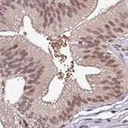 Immunohistochemical staining of human gallbladder using Anti-DR1 antibody HPA050785.