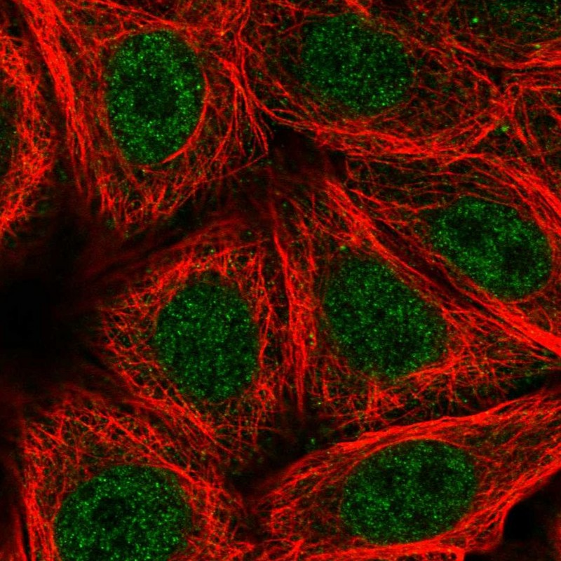 Anti-ZNF789 Antibody