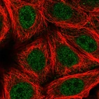 Anti-ZNF789 Antibody
