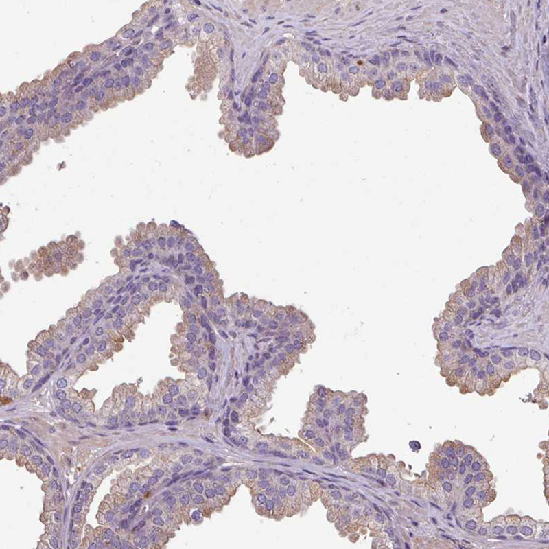 Anti-ISLR Antibody